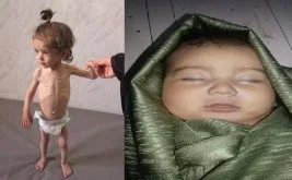 Humus ve Şam’da çocuk ölümleri artıyor