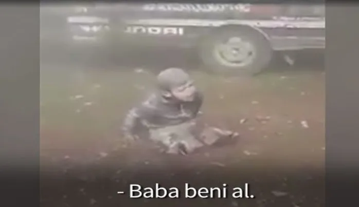 Bombardımanda iki bacağı kopan çocuğun feryadı yürek dağladı (VİDEO)