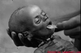 Afrika’da 17 milyon insan acil gıda bekliyor