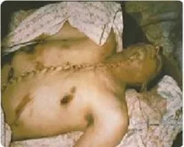 Siyonistlerin organ hırsızlığı belgelendi