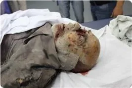 İşgal ordusu Gazze’de yine terör estirdi: 17 ölü, onlarca yaralı