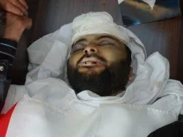 Suriye’de şimdi şehadet vakti (Foto)