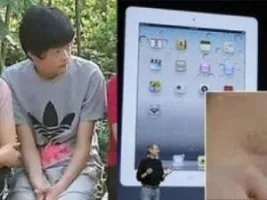 Teknoloji tutkusu; Apple için böbreğini satınca hayatı karardı