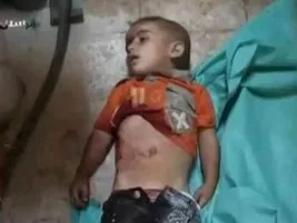 Suriye’de katliam sürüyor: 172 Müslüman daha katledildi