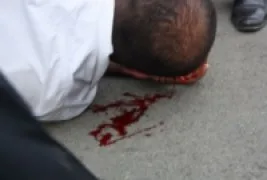 Azerbaycan’da Hicab direnişine kanlı saldırı