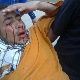 Mısır’da polis ateşiyle 5 gösterici katledildi