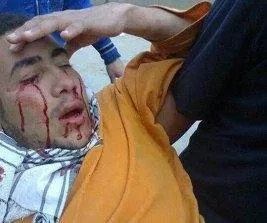 Mısır’da kanlı cuma: 17 gösterici katledildi