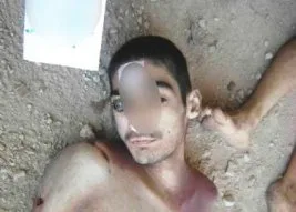 Suriye’deki insanlık suçu yeni fotoğraflarla belgelendi
