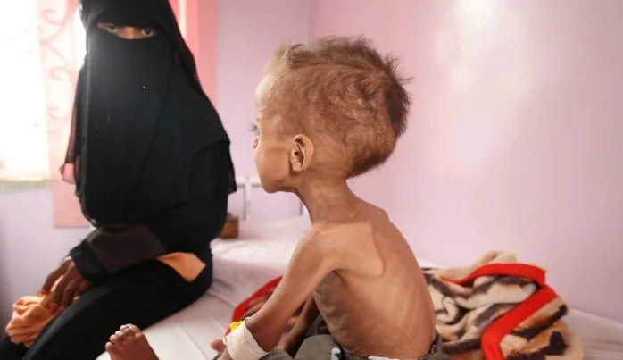 Yemen’deki insani kriz büyük boyutlara ulaştı