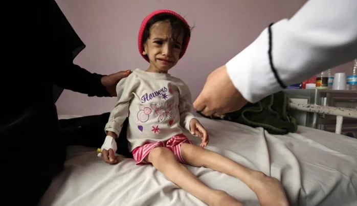 Doğu Afrika ve Yemen için acil yardım çağrısı