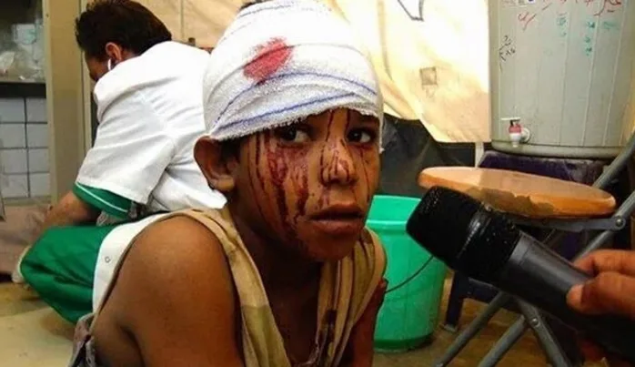 Yemen’de açlık intihara sürüklüyor