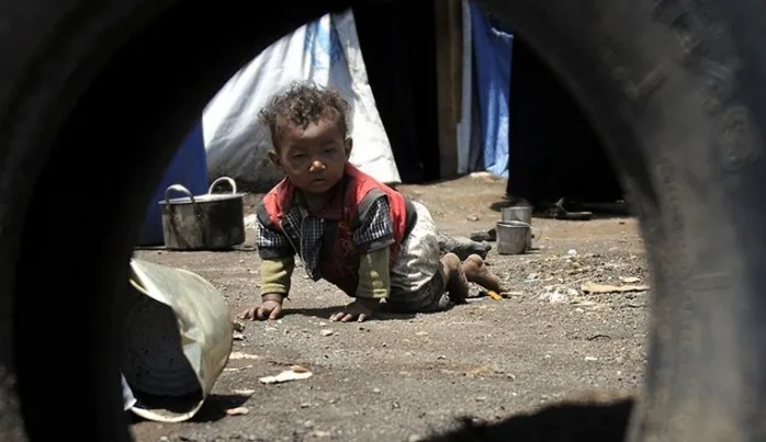 Yemen’de 7 milyon kişi açlık tehlikesiyle karşı karşıya
