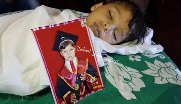 Gazze ablukasının son kurbanı 5 yaşındaki Muhammed
