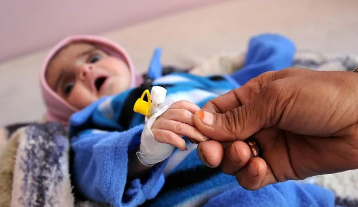 Yemen’de her 10 dakikada 1 çocuk ölüyor