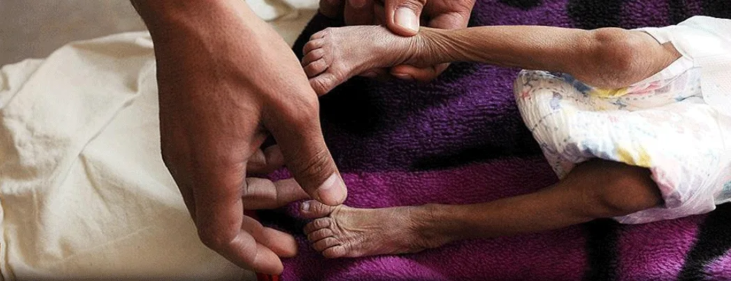 ICRC: Milyonlarca Yemenli aç uyuyor