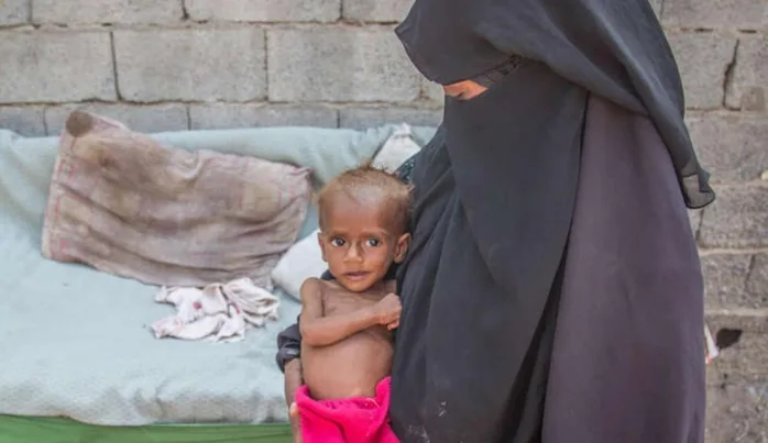 Yemenli çocuklar için ekmek yardımı çağrısı