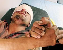 <FONT face=Georgia size=4>İşgal altındaki Irak’ta insanlık dramı: 8 milyon Iraklı acil yardıma muhtaç</FONT>