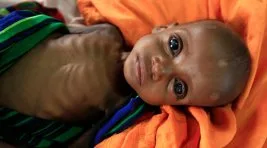 Somali’de kıtlık en çok çocukları vuruyor