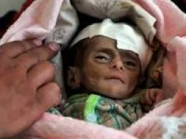 Yemen’de açlık krizi!